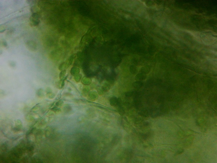 Portulaca grandiflora - Onze-horas - Folha - células