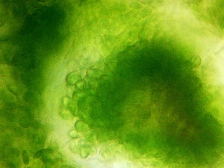Portulaca grandiflora - Onze-horas - Folha - células