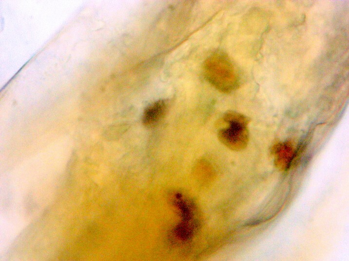Aleurodicus pseudugesii - Mosquinha Branca de Coqueiro - abdomem